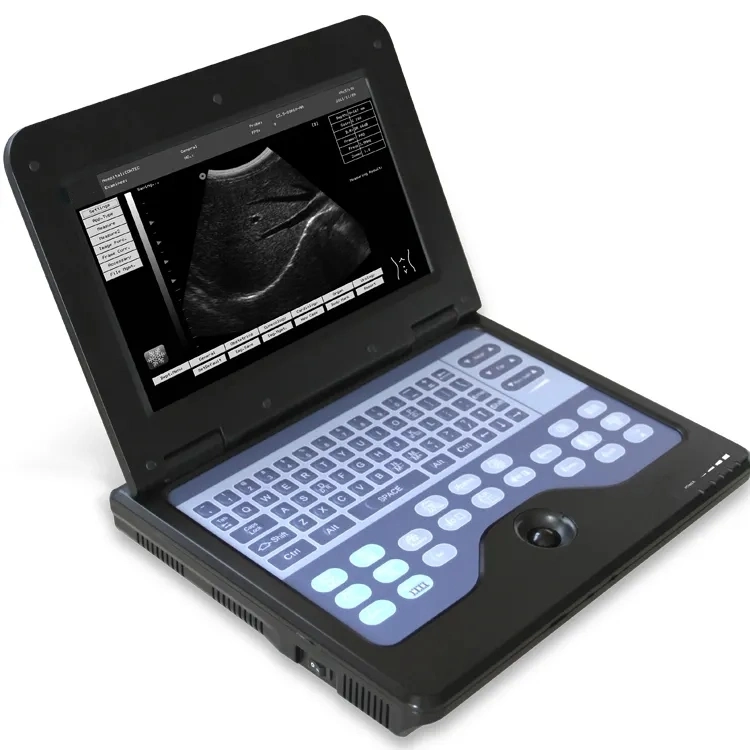 CE Approved Laptop Portable Digital B Ultrasound Diagnostic System Ultrasound Machine