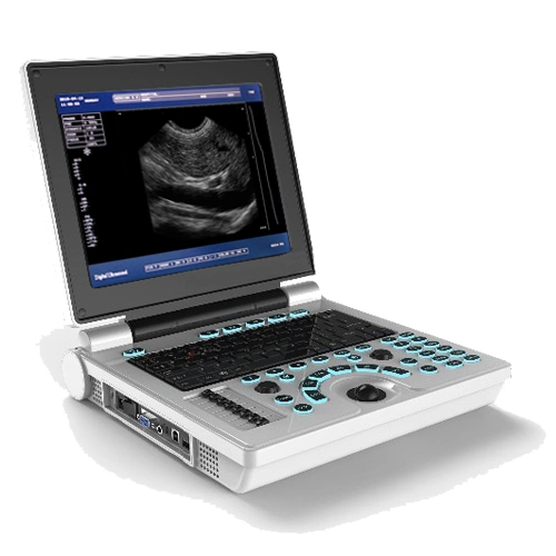 Full Digital Ultrasound Scanner Diganostic Scanning System Xf30b