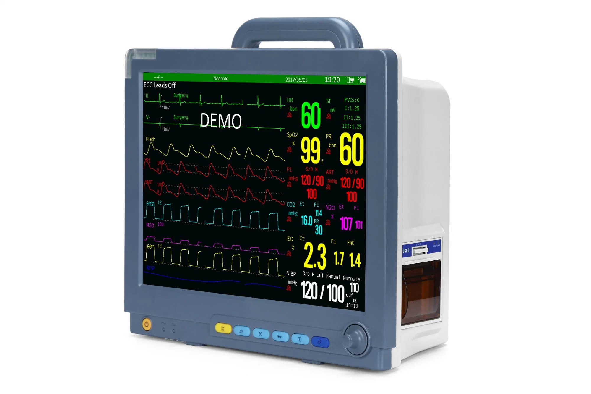 Sinnor portátil de 15 pulgadas Monitor de paciente con el sistema de centro de WiFi (SNP9000M) /monitor de ECG/Monitor cardíaco