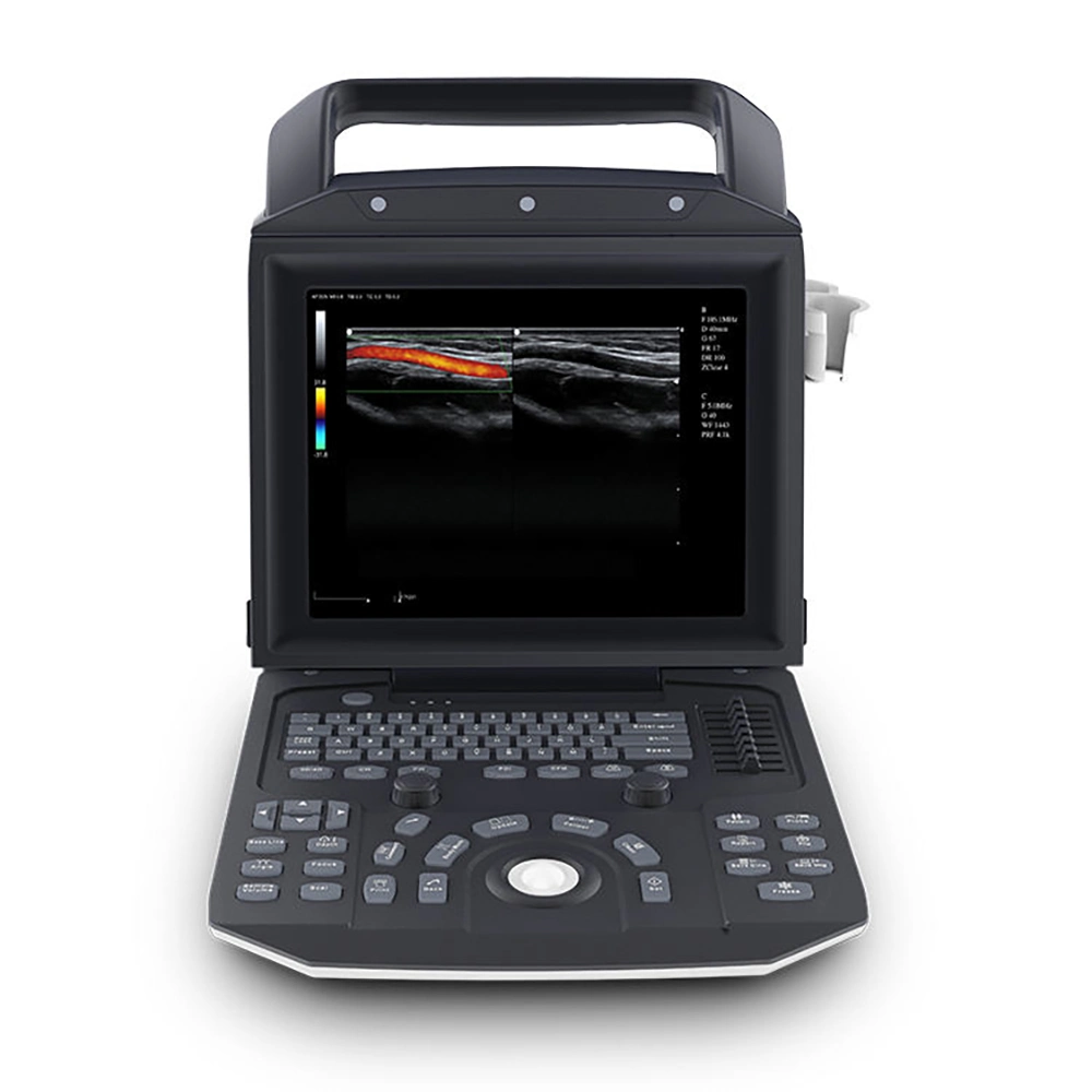 Портативный медицинский портативный компьютер 3D 4D Ultrasonic Ecografo Color Doppler Cardiac Ультразвуковая система