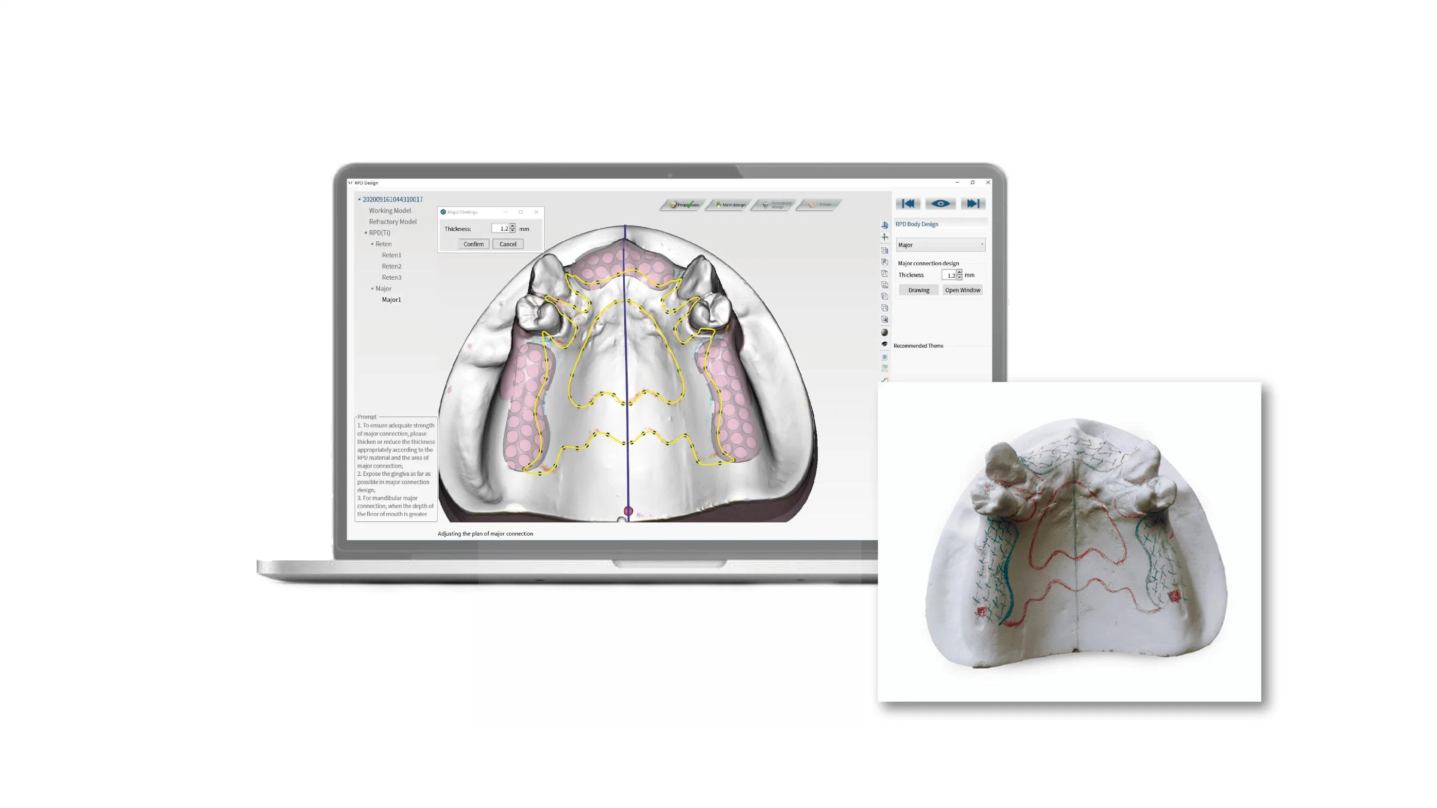 طابعة ثلاثية الأبعاد لأسنان مع برنامج CAD&amp;CAM لمعمل الأسنان