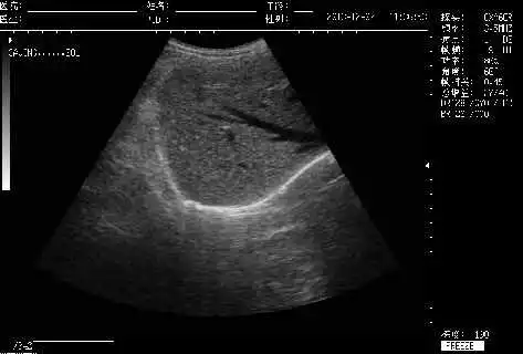 Tragbarer volldigitaler S/W-Ultraschallscanner