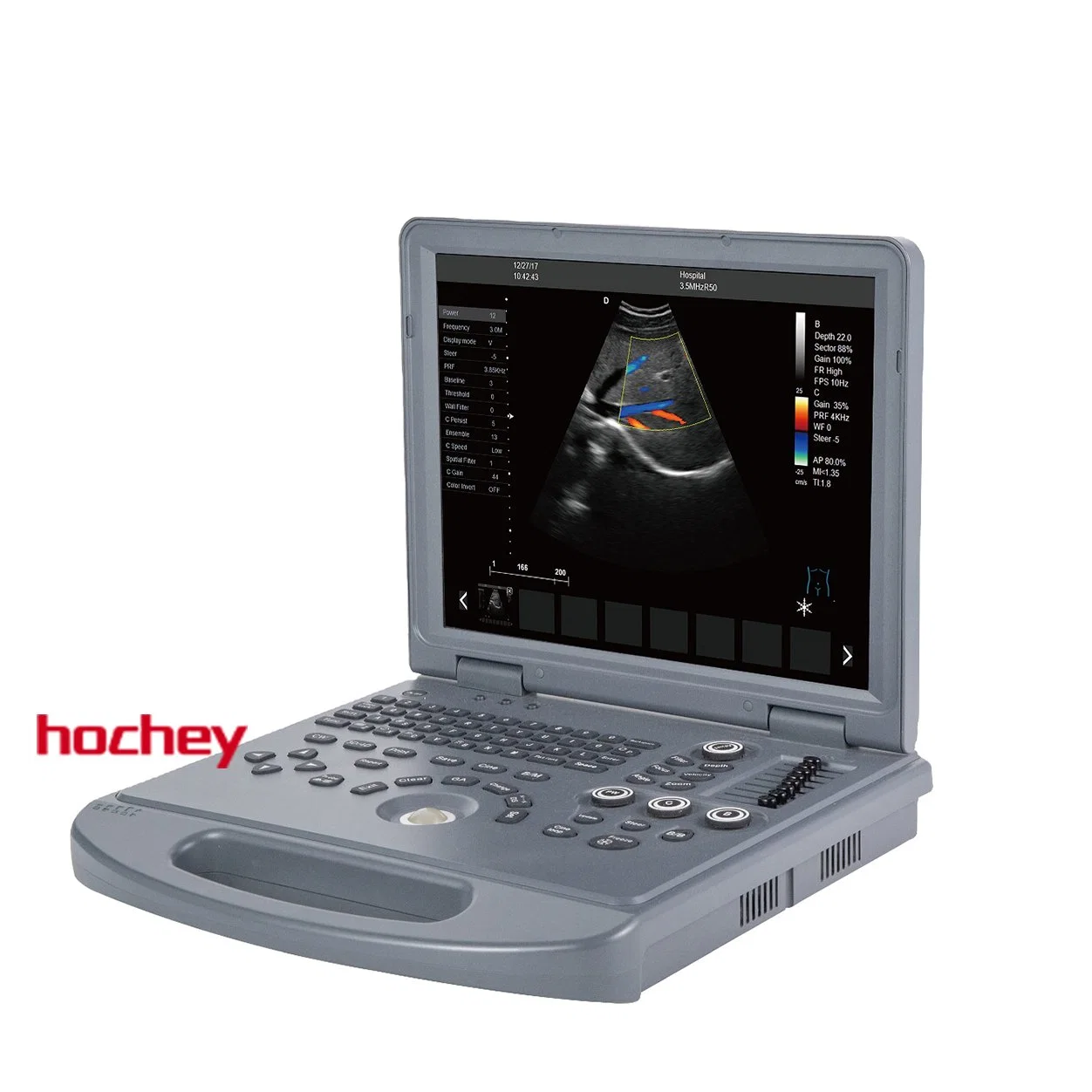 Médico de hochey portátil 4D de la máquina de ultrasonido Doppler Color de la fábrica