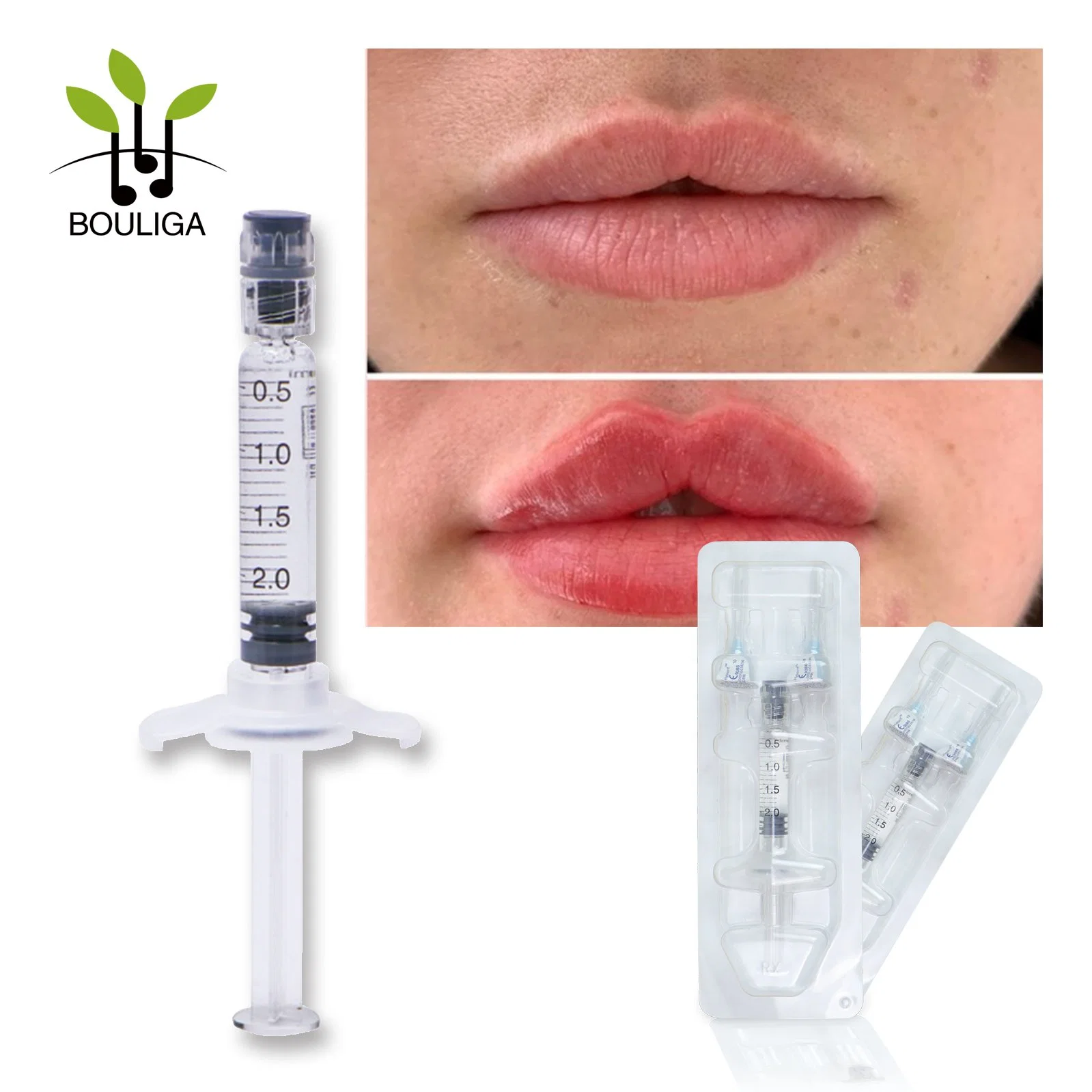 Hyaloronic Acid Injection 2ml Cross Linked Derm Hyaluronic Acid for Plumps up Lips