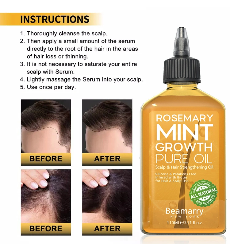 Уход за волосами лечение иммунной сыворотки органических природных эфирного масла масло для роста волос черный женщина Private Label
