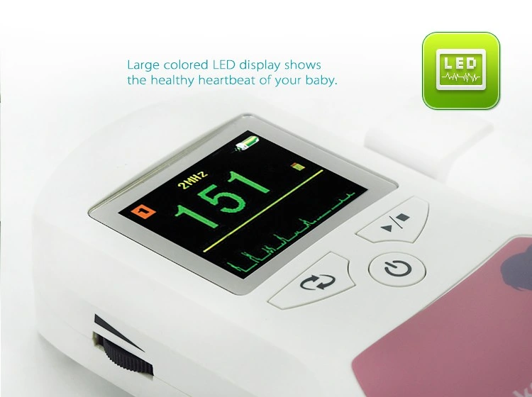 Fetal Heart Doppler Detector-Color Display (Sonoline C)