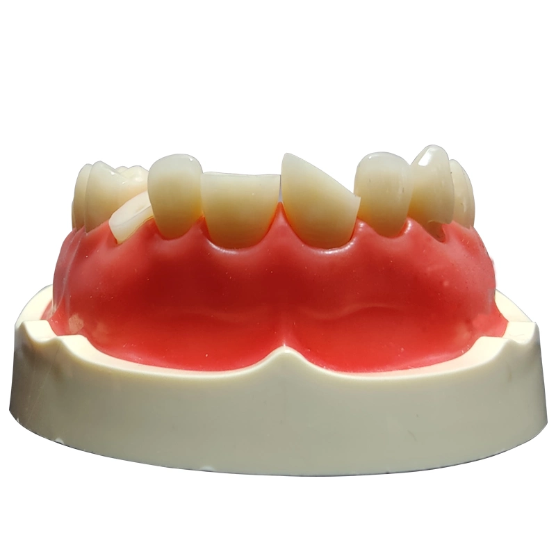 Dynamic Dental Teaching Tooth Model for Clinic or Hospital Use