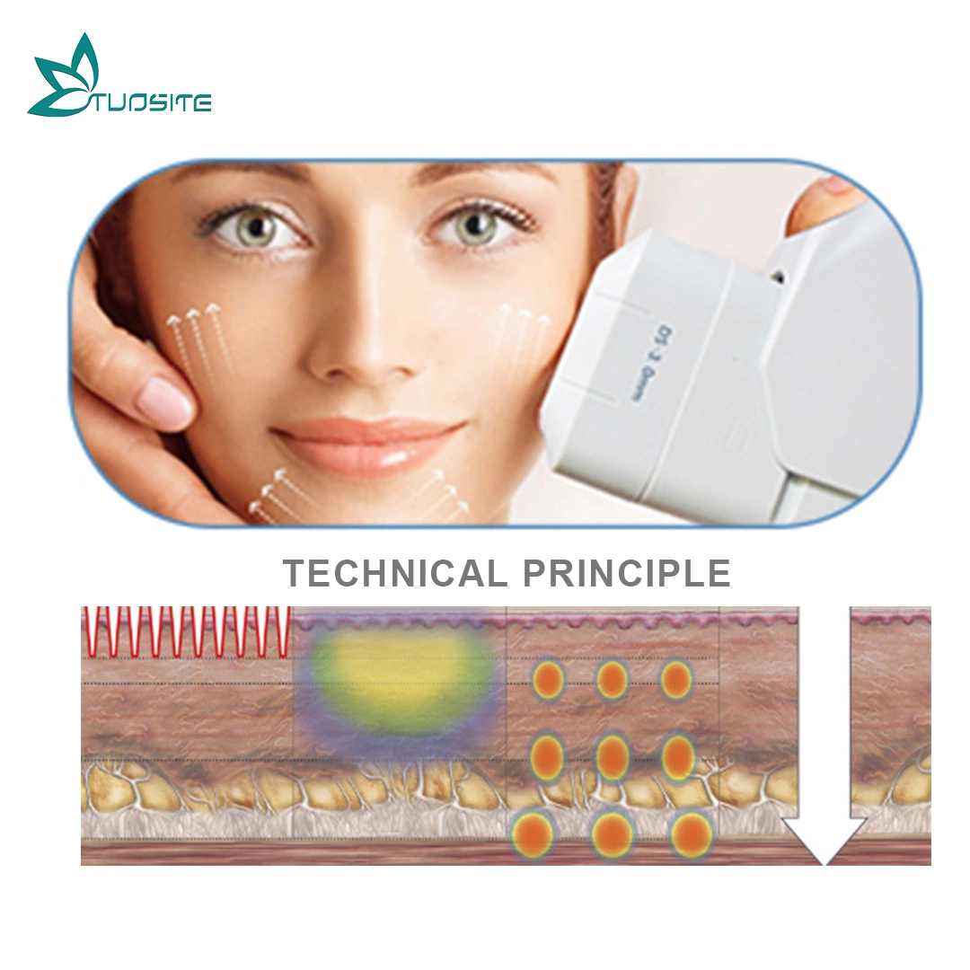 Centro de Estética médica Use Mini HIFU Face Lifting Beauty Machine