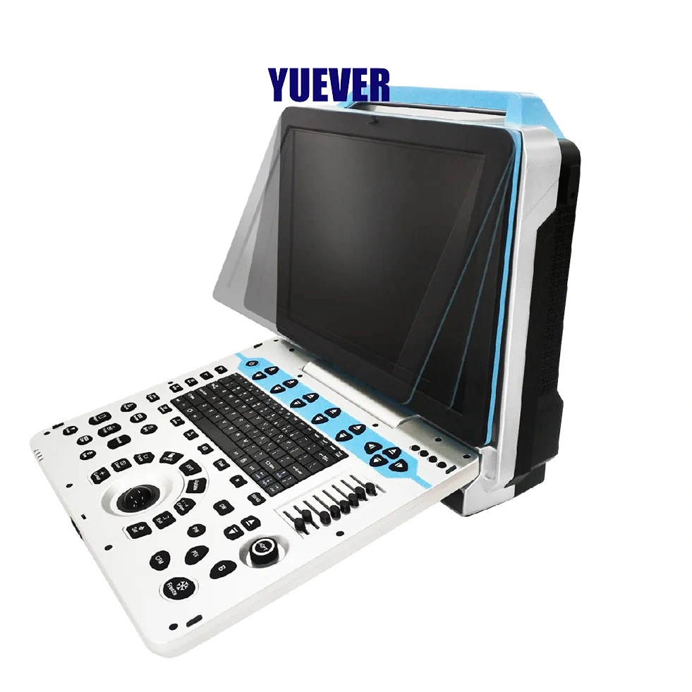 Yuever Medical Hot Sale Medical Ultrasound Instruments for Hospital Clinic Utilize ecografia veterinária da máquina de ecografia de ovinos