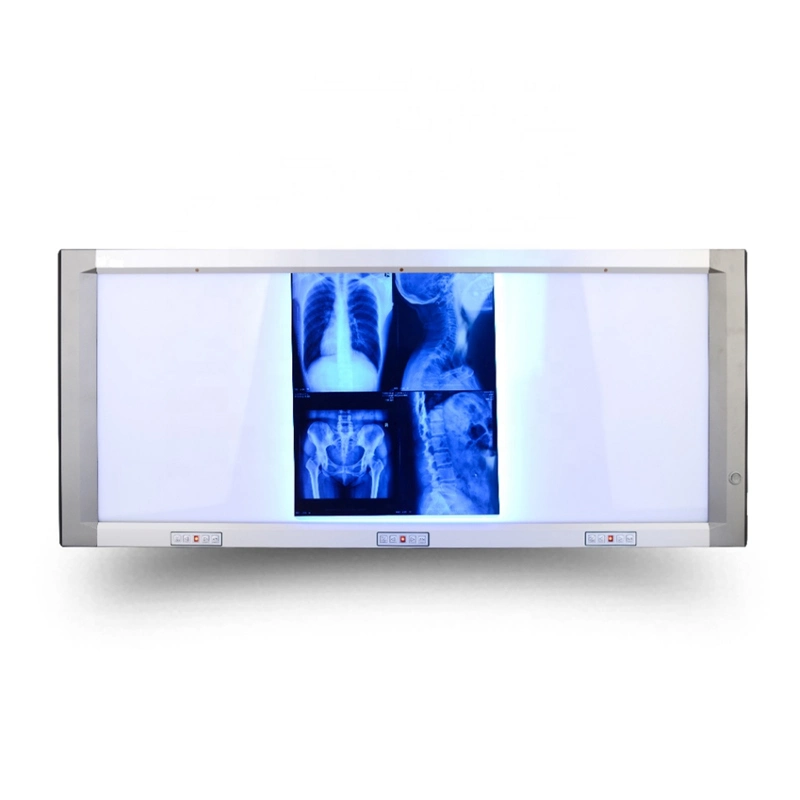 Super Thin Tragbare Doppelwand Röntgenlicht LED medizinische Folie Viewer