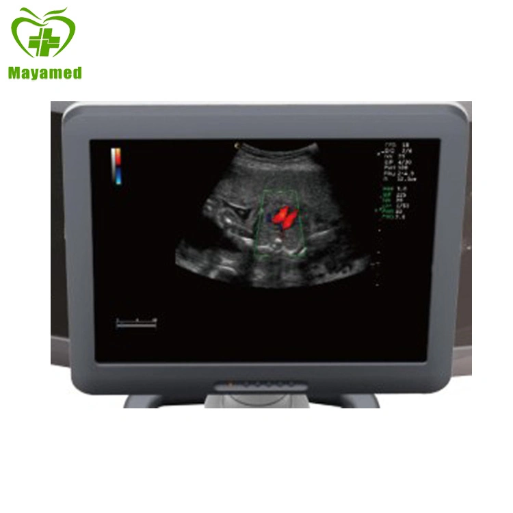 My-A029 19 Inch 3D/4D Color Doppler Ultrasound System