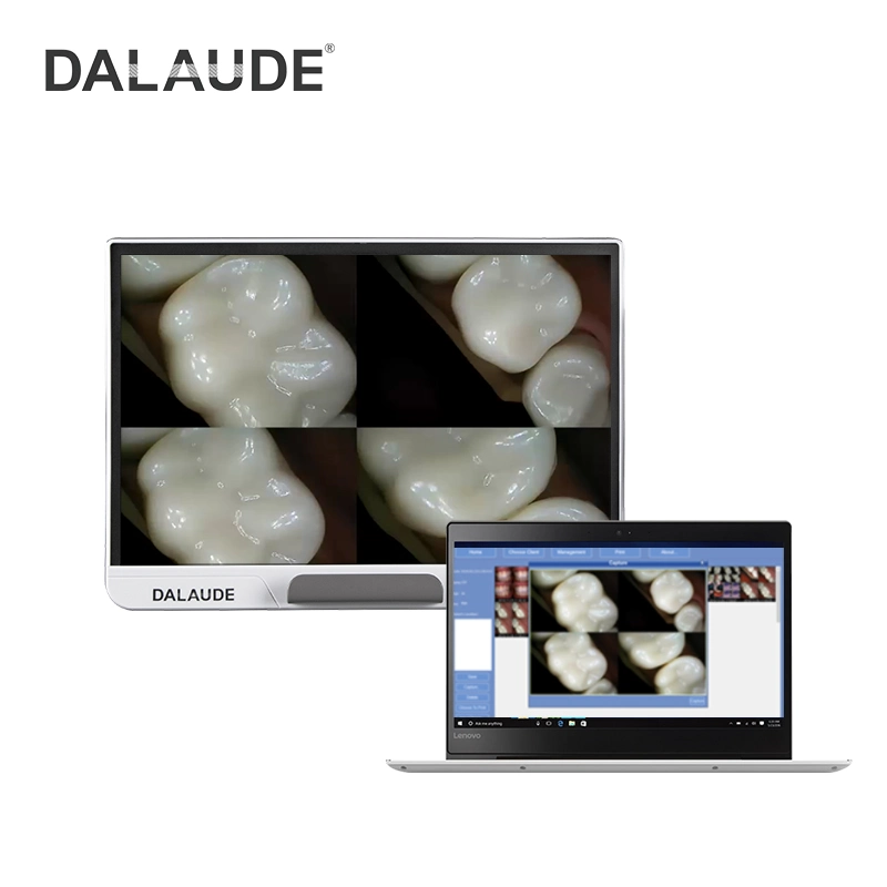 La fabricación de 17/19Dental pulgadas Intra Oral modelos de cámara con puerto HDMI