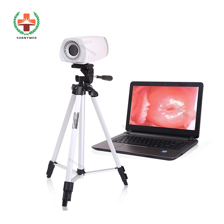 High quality/High cost performance  Hot Sale Women Portable Electronic Colposcope Price