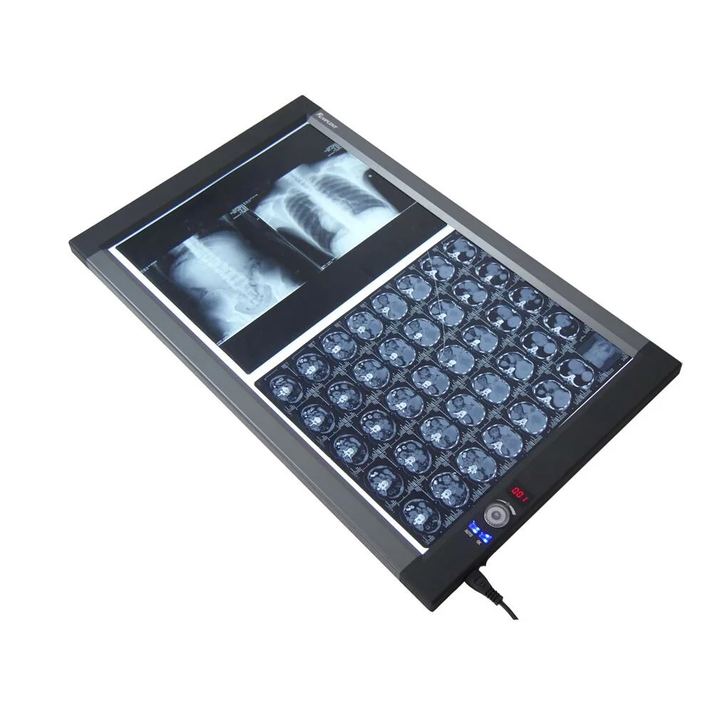 LED X Ray Viewer, Negatoscope, Medical Film Viewer Double Screen Zg-2c