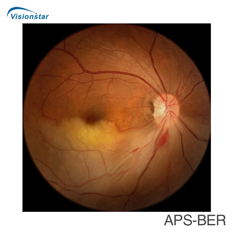 Fondo de ojo de la cámara y angiografía fluoresceínica System