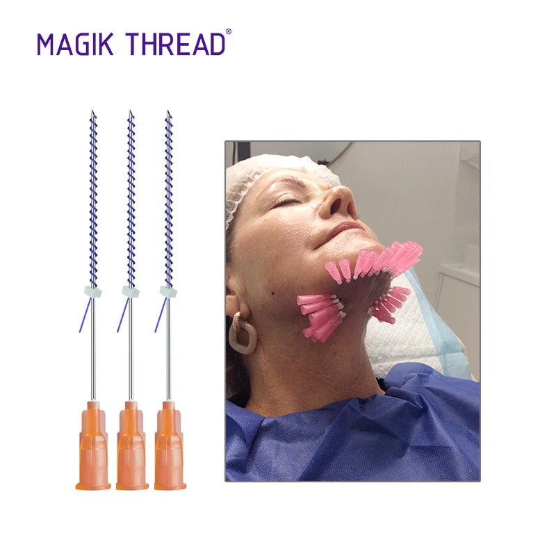 Magik Thread Disposable Medical Supplies Tear Trough Pdo Threads for Face Lifting