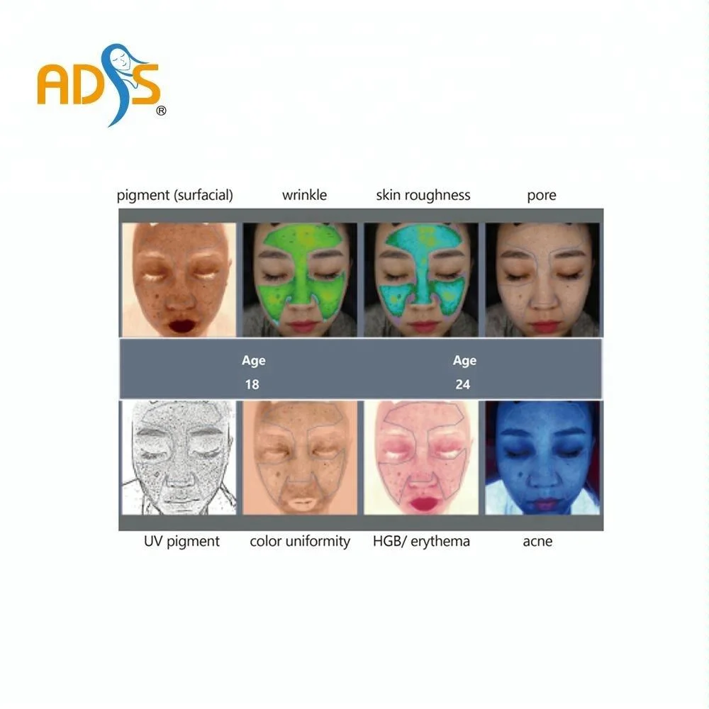 ADSS Newest Skin Analyzer Beauty Machine for Skin Analysis