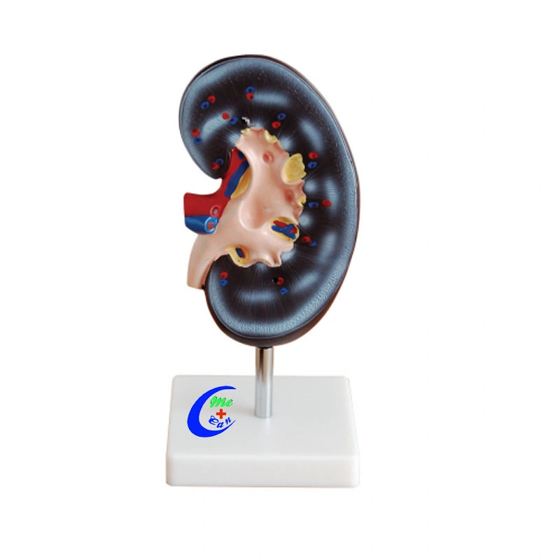 Enlarged Human Kidney Model with Adrenal Gland