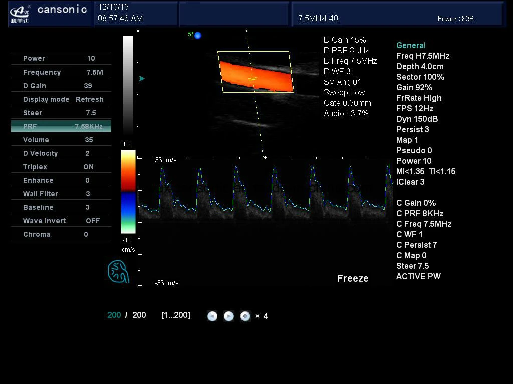 Carrinho para instrumentos médicos 4D Gyn