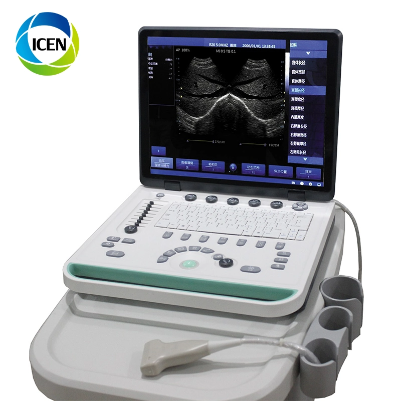 IN-A032-2   Diagnostic Full Digital Laptop Home Ultrasound Scanner Ultrasound Machine