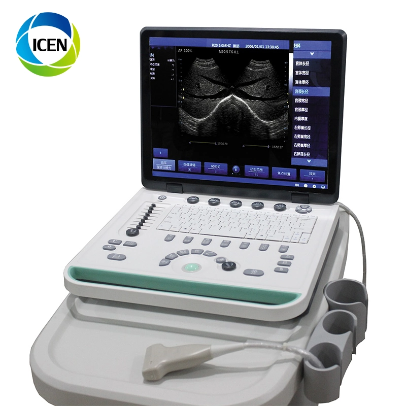 IN-A032-2 Diagnóstico Full Digital Laptop Home Ultrasound Scanner Ultrasonido máquina