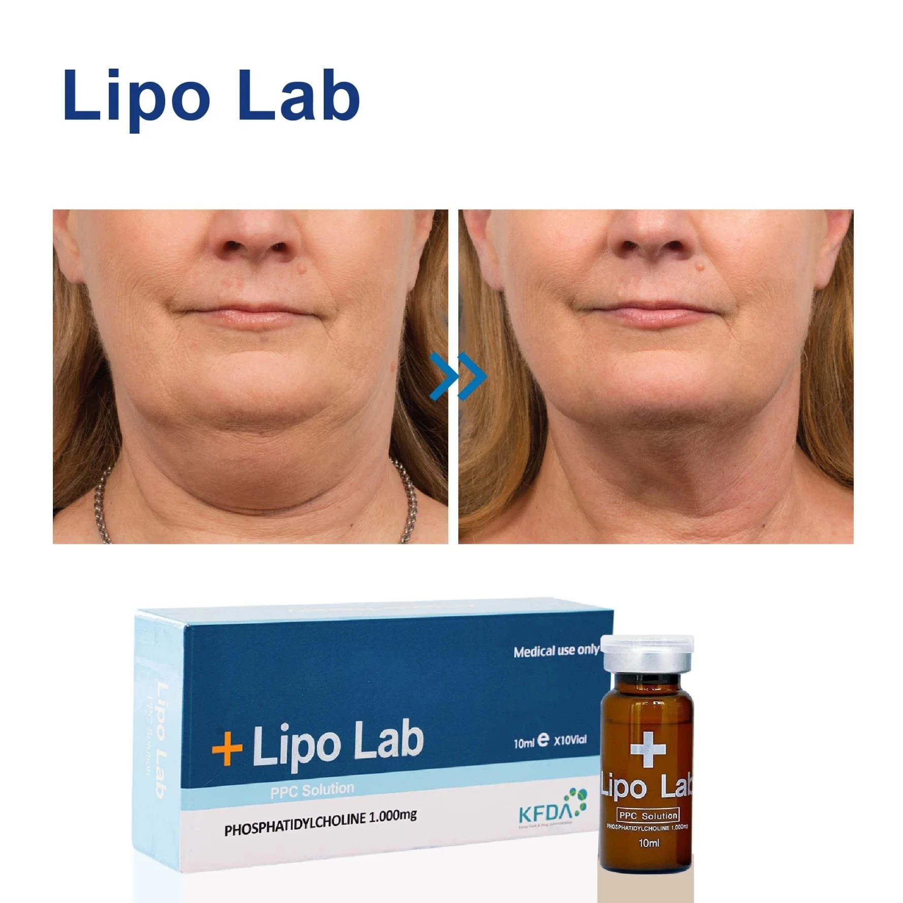 LiPo Lab PPC Lipolytic solution lipolytique injection Lipo-Lab Kabelline Lipo Lab V-Line Belkyra Saxandr