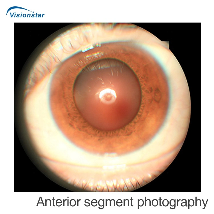 Не-3100 Reticam mydriatic дна матки пациентки глаз автофокусировки камера