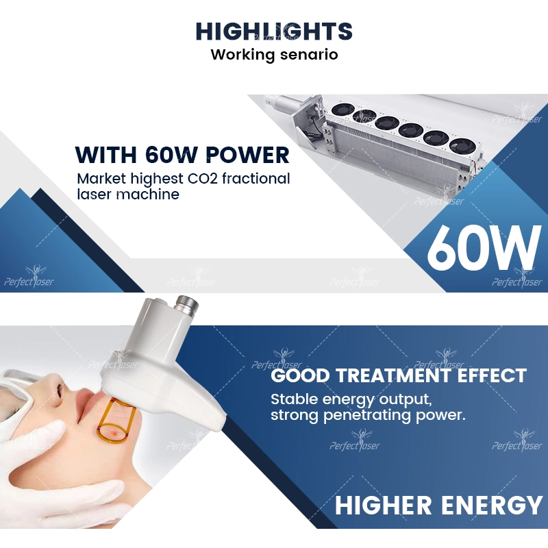 Dispositivo de corte láser profesional de pigmento de eliminación de marcas de estiramiento CO2