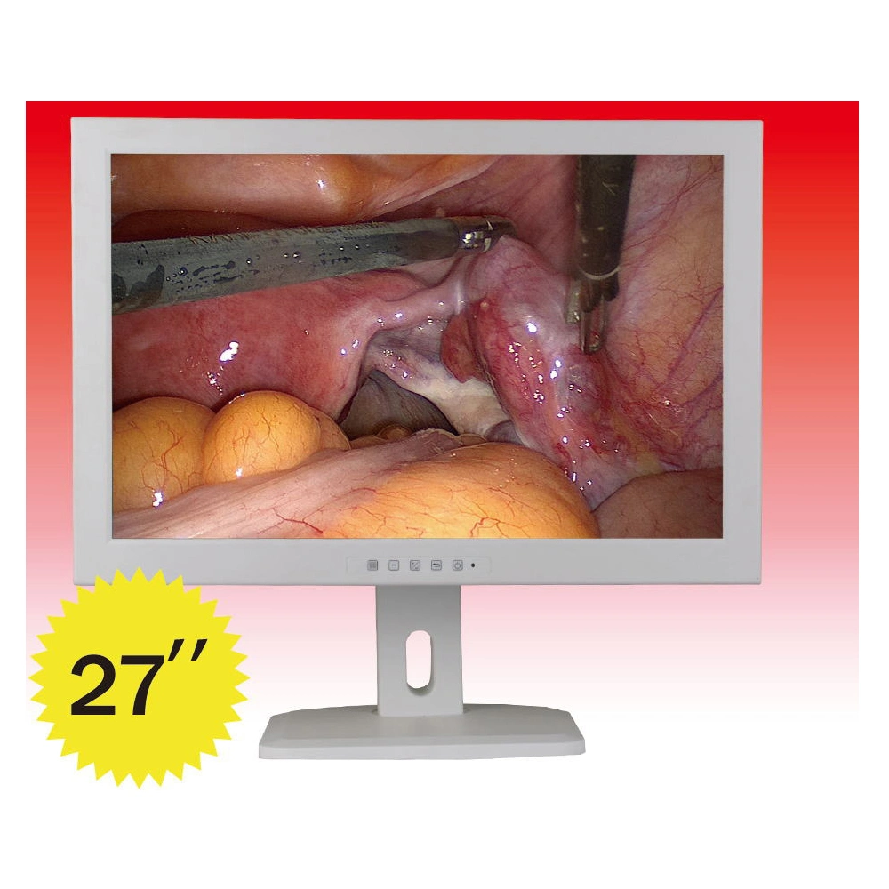 HD LCD Monitor Screen Endoscope Equipment Medical Monitor Surgical Endoscopy Medical Monitor