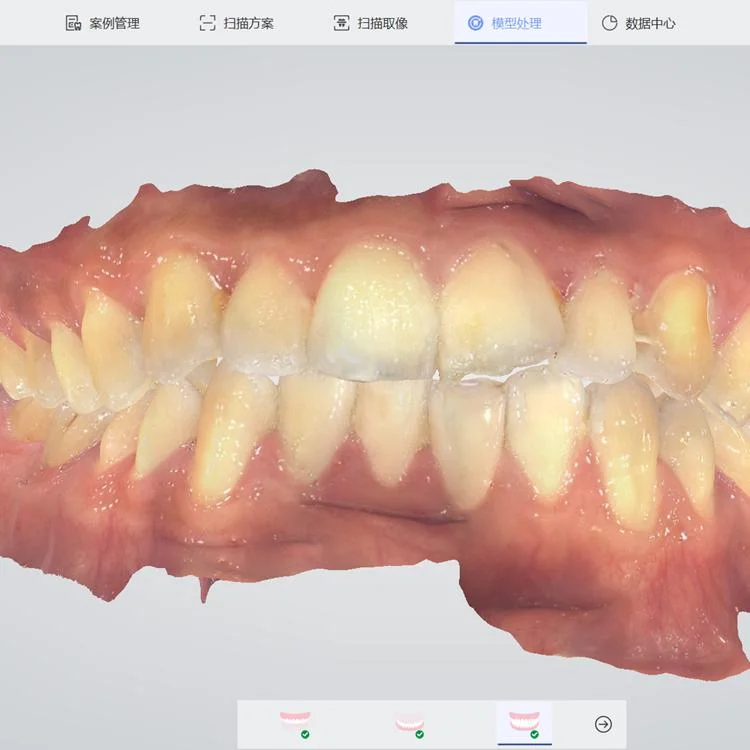 Китай Panda 2 Синяя Интраоральный сканер 3D Dental Lab CAD Цена CAM с CE