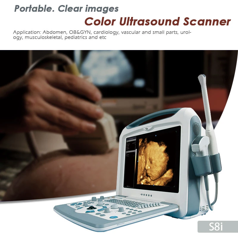 Amazing Color Portable Ultrasound Scanner with Multi Frequency Convex Probe Standard