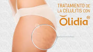 PLLA Olidia Lip Dermal Filler Injection refuerzo de la piel Etrebelle estimular Colágeno