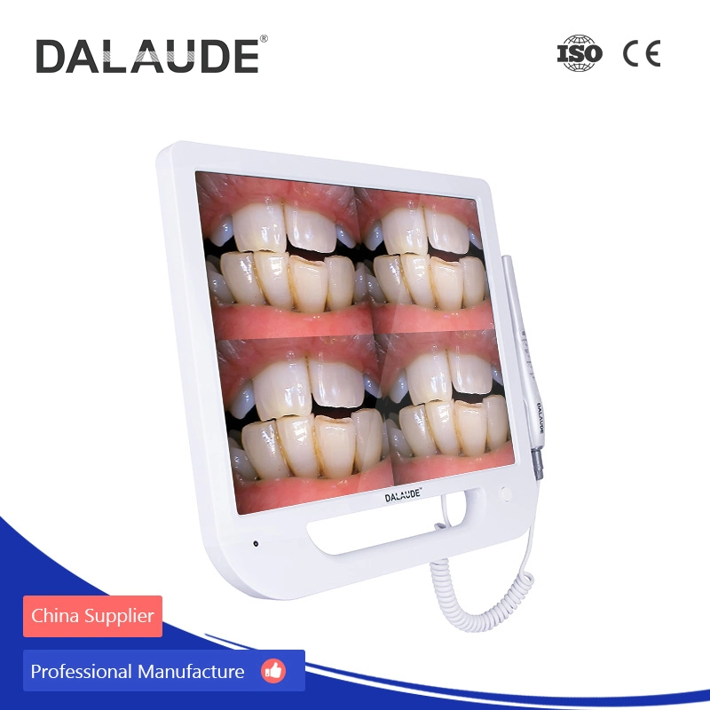 Mégapixels caméra dentaire clinique de l'endoscope Intraoral moniteur HD