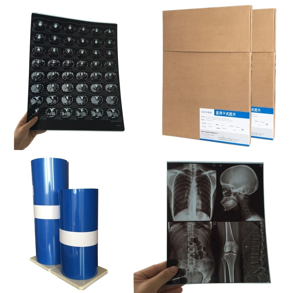 Blue Color Medical 18*24 Cm Inkjet X Ray Dry Film