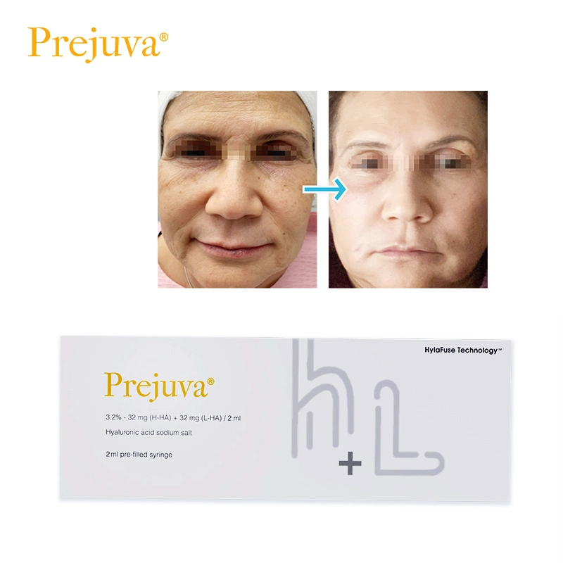 Prejuva 2ml mejore el cuidado de la piel Anti-Aging Prohilo Anti-arrugas cara de suero Elevación del relleno dermal H L