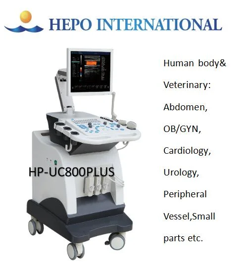 3D Ultrasound Scanner Diagnosis System for Hospital