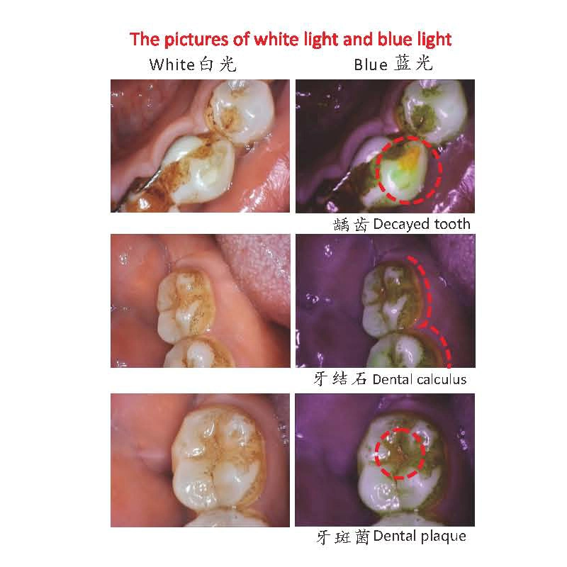 La luz azul y blanco de la Cámara Intraoral Dental de alta definición con HDMI y VGA Salida para la gran pantalla de televisión