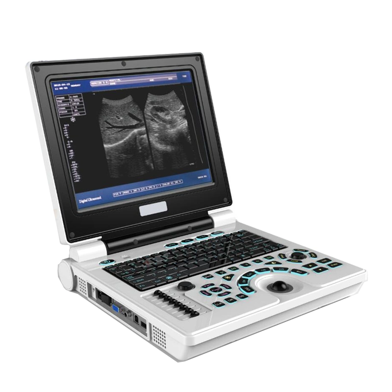 My-A008d Cheap Price Hospital Instrument Laptop Ultrasound Machine Portable Notebook Ultrasound Scan