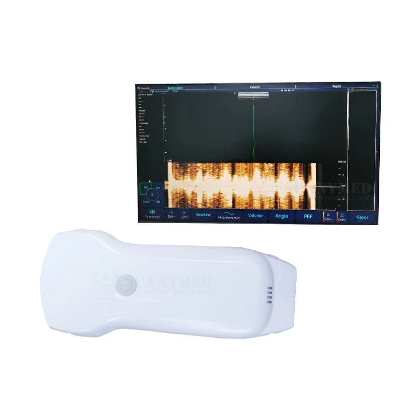 Sy-A053cl Wireless Wi-Fi Ultrasound Mini Handheld Ultrasound Machine for Android Windows System