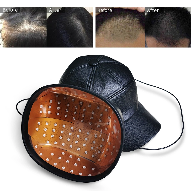 Laser Cap Hair Growth Hat Grow Hair Back Medical Laser Therapy Equipment Helmet