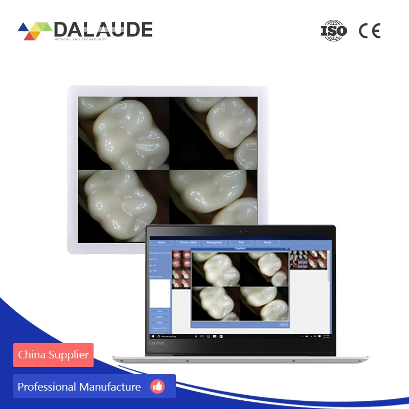 Atualizado em função da Unidade de medicina dentária Digital Oral Cam exibindo dispositivo pode transmitir imagens