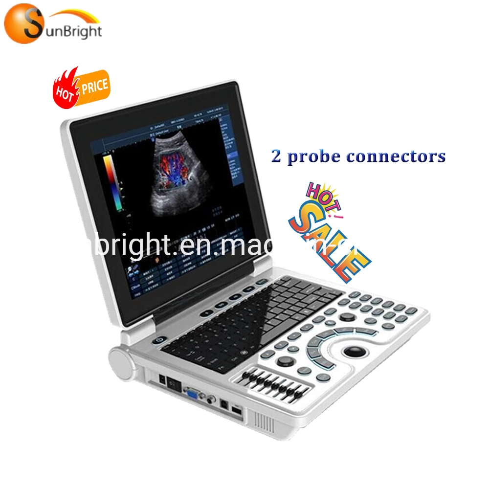 Sun-806h Clear Image Ultrasound Machine Laptop Portable USG Ultrasonic