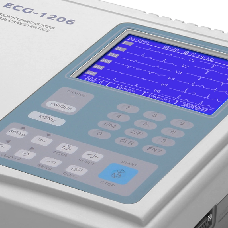 Diagnosis profesional portátil el Equipo de Canal 6 máquina de ECG/EKG