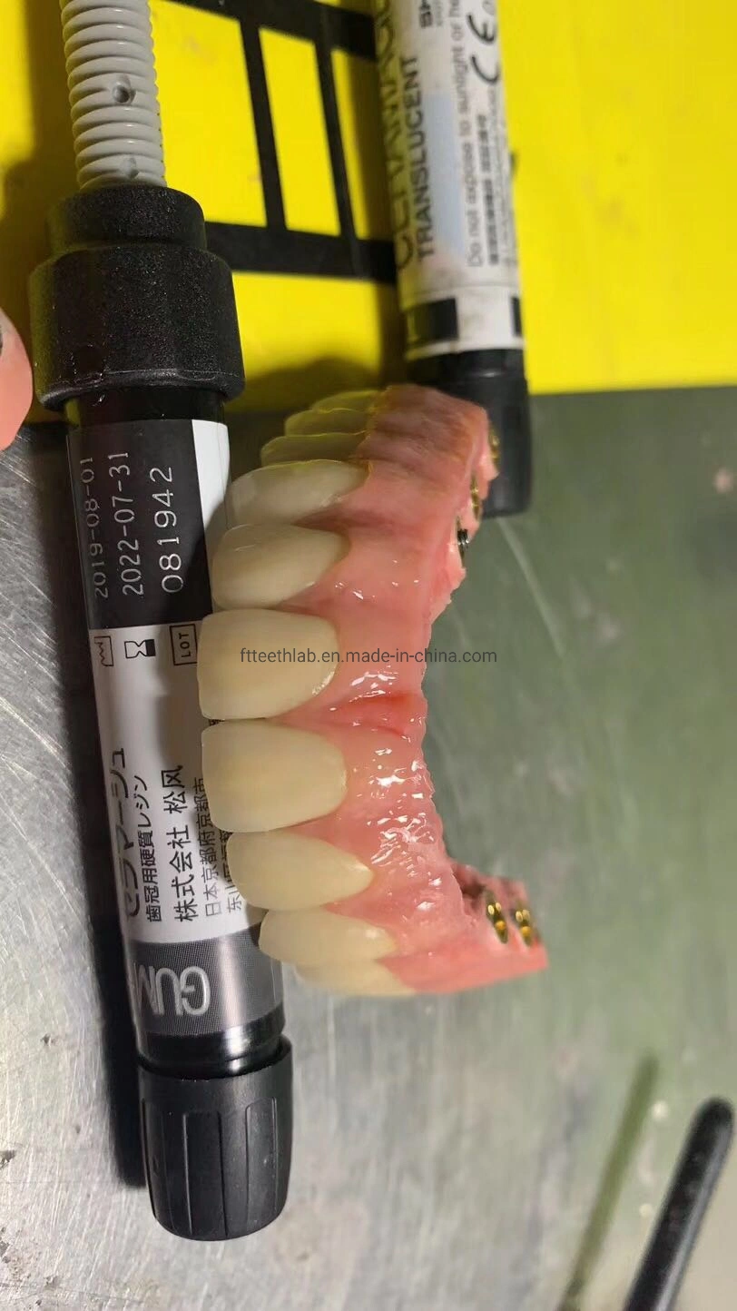 Full Arch Layered Zirconia Implant Bridge Dental Implants