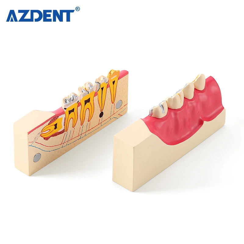 Zahnmedizinisches Lernmodell Rechtes Unteres Posteriores Zahnmedizinisches Gewebezersetzungsmodell