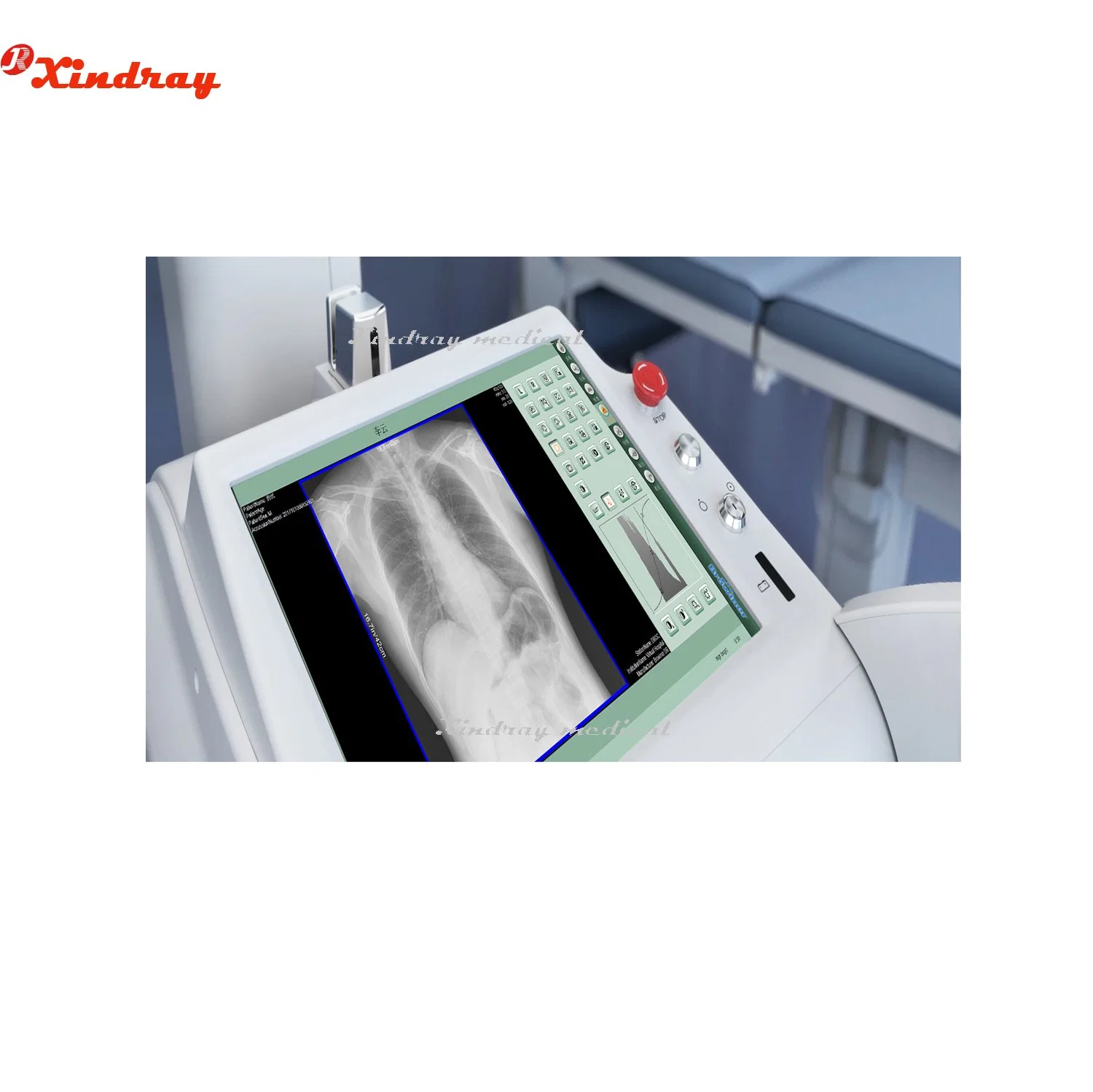 High Perfermance New Style 32kw X-ray Machine Adjustment Form for Radiography