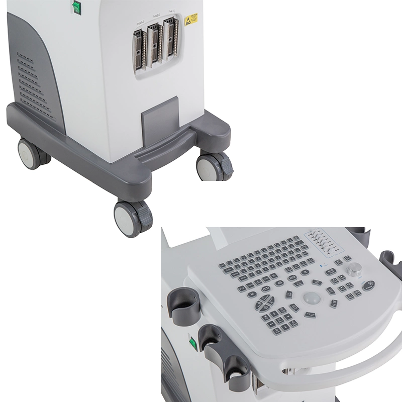 Mecanmed Doppler Scanner Equipment 4D máquina de ecografía médica con CE Precio bajo