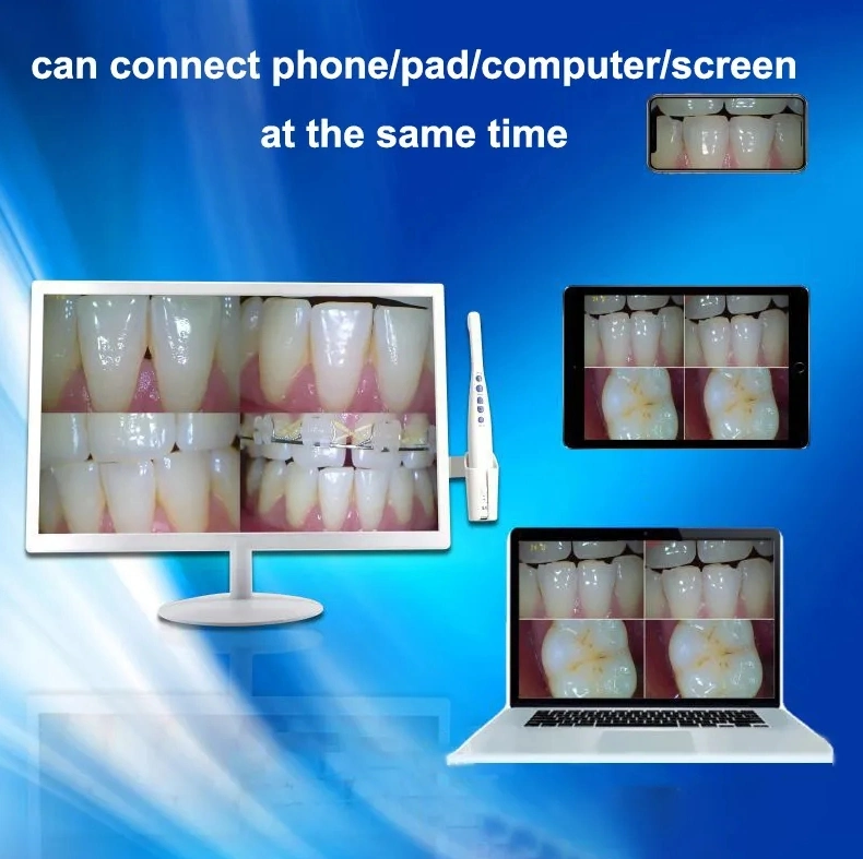 Intra-Oral dentaire caméra avec écran de moniteur matériel pour la clinique