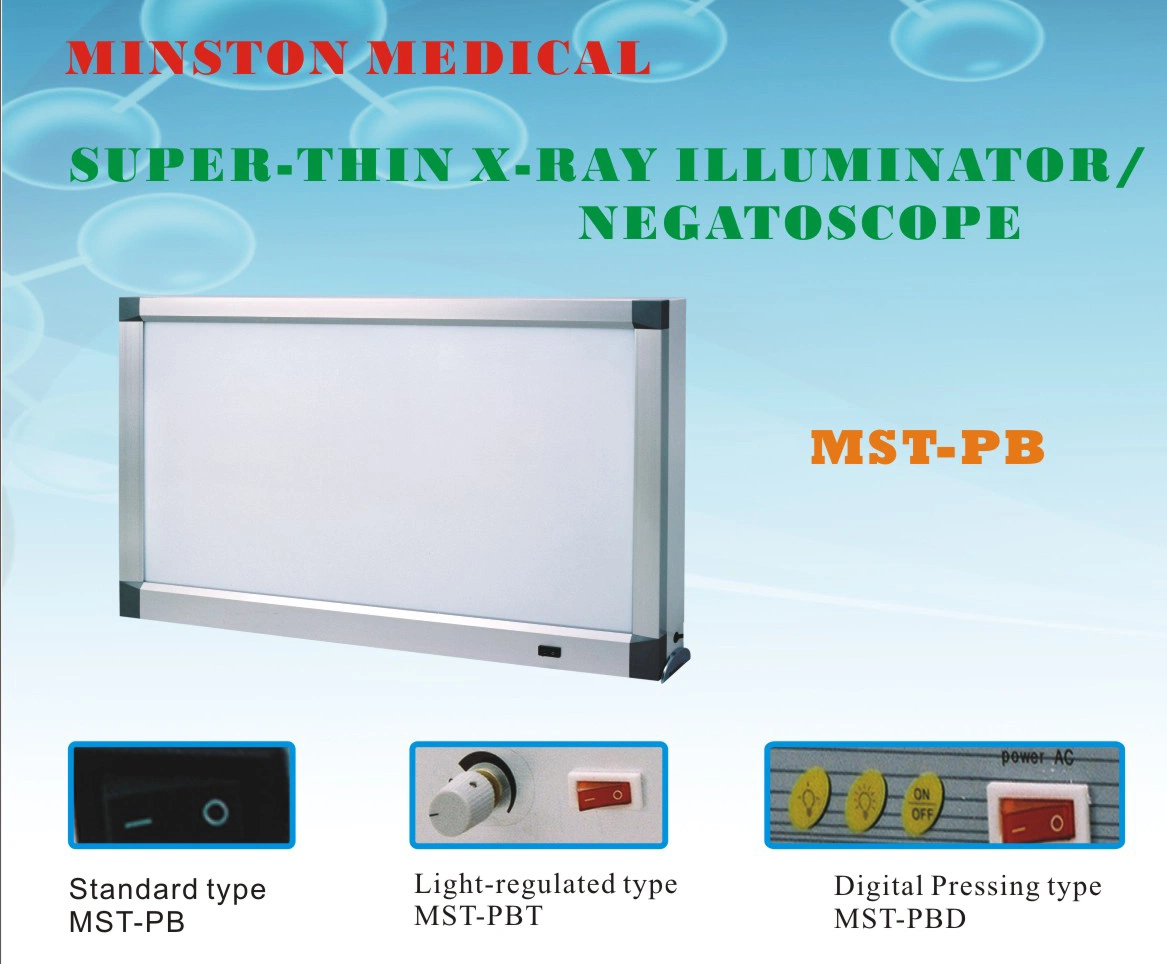 Easywell Fluorescent Three Union Mst-Pb Switch on/off X-ray Film Viewer