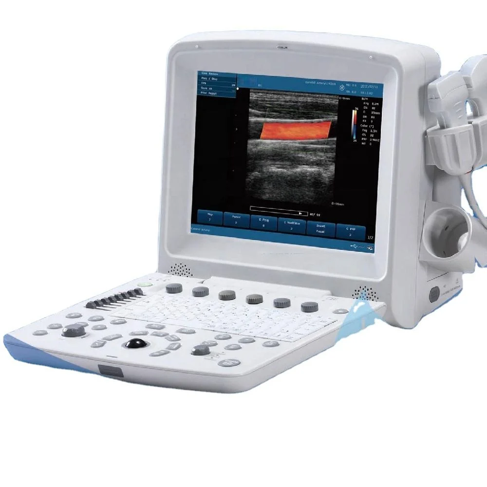 Edan U50 12.1 Inch Portable Color Doppler Ultrasound